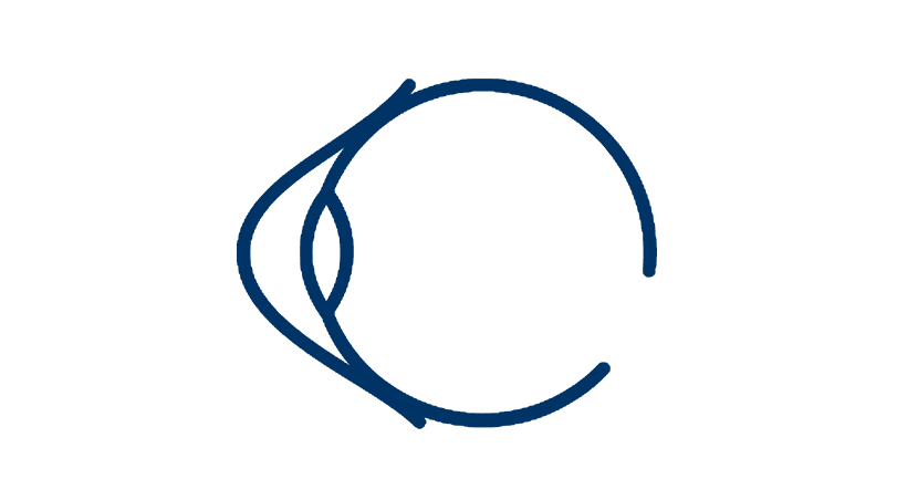 Keratoconus Treatment and Eye Surgery | Advanced Care in Mexico | CODET ...