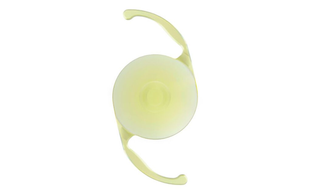 Yellow-tinted intraocular lens implant with curved supporting arms on a white background.
